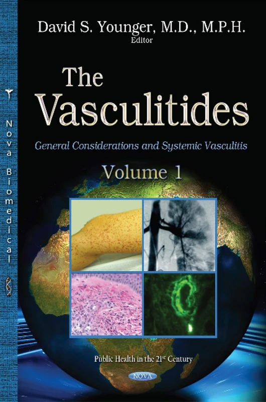 The Vasculitidies, Volume 1: Volume 1 -- General Considerations & Systemic Vasculitis