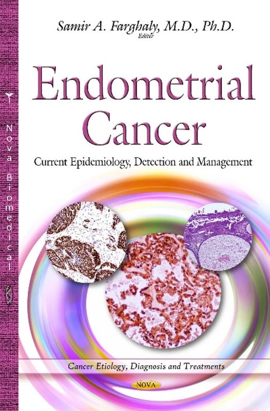 Endometrial Cancer: Current Epidemiology, Detection & Management (Cancer Etiology, Diagnosis and Treatments)