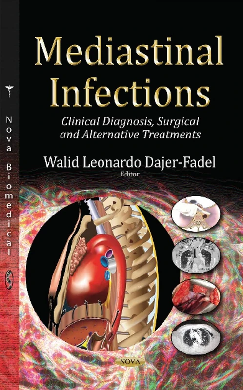 Mediastinal Infections: Clinical Diagnosis, Surgical & Alternative Treatments (Allergies and Infectious Diseases)