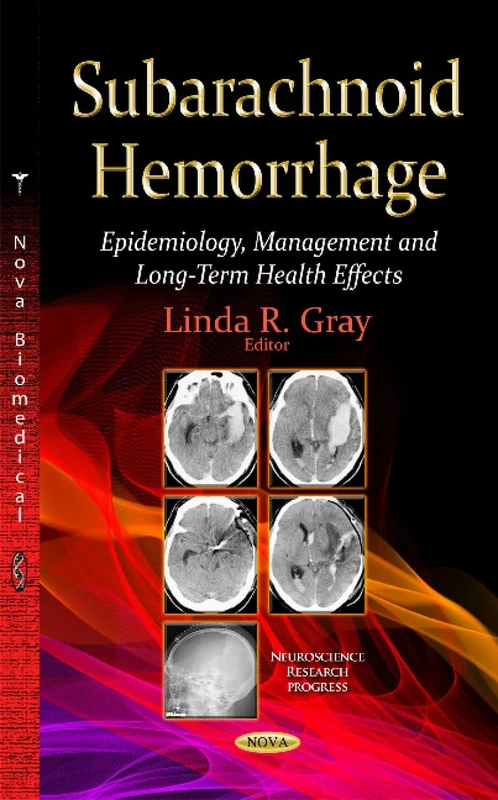 Subarachnoid Hemorrhage: Epidemiology and Management Book - Image 1