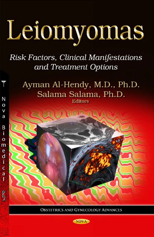 Leiomyomas: Risk Factors, Clinical Manifestations & Treatment Options