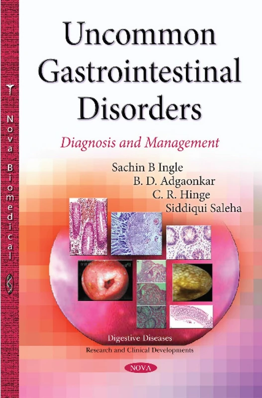 Uncommon Gastrointestinal Disorders: Diagnosis & Management (Digestive Diseases-research and Clinical Developments)