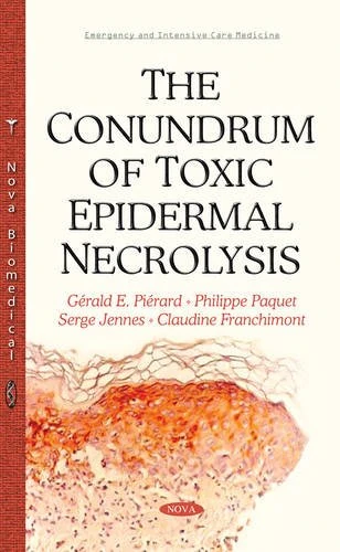 Conundrum of Toxic Epidermal Necrolysis - Image 1