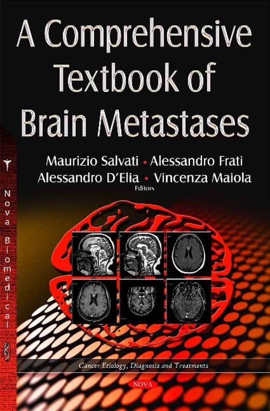 Comprehensive Textbook of Brain Metastases (Cancer Etiology, Diagnosis and Treatment)