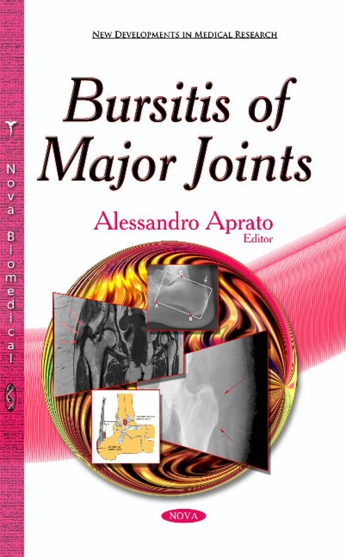 Bursitis of Major Joints (New Developments in Medical Research)