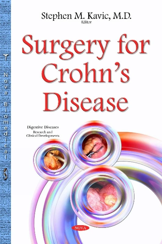 Surgery for Crohn s Disease (Digestive Diseases - Research and Clinical Developments)