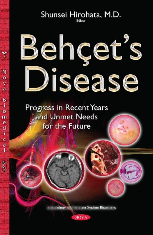 Behcet s Disease: Progress in Recent Years & Unmet Needs for the Future