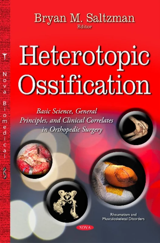 Heterotopic Ossification: Basic Science, General Principles, and Clinical Correlates in Orthopedic Surgery