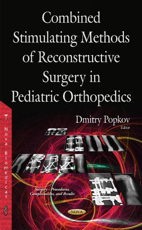 Combined Stimulating Methods of Reconstructive Surgery in Pediatric Orthopedics