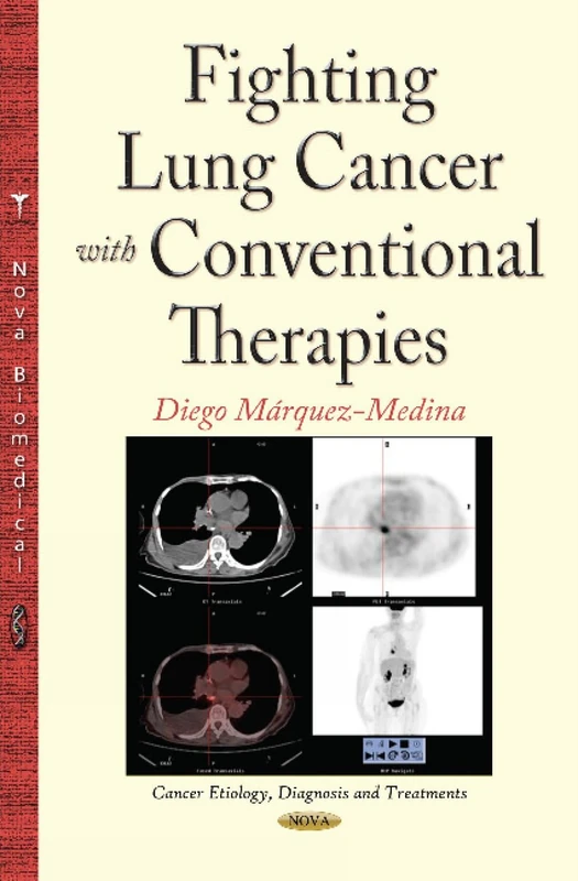 Fighting Lung Cancer with Conventional Therapies