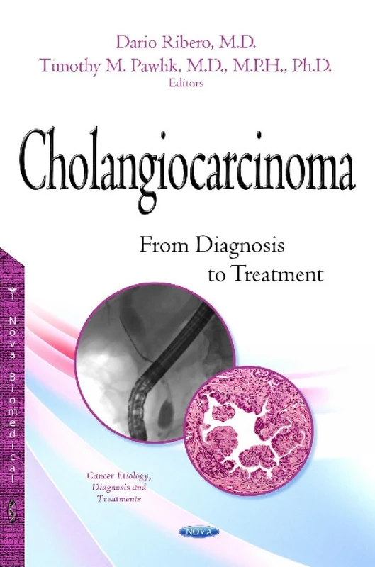 Cholangiocarcinoma: From Diagnosis to Treatment (Cancer Etiology, Diagnosis and Treatment)