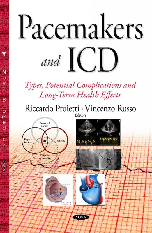 Pacemakers & ICD: Types, Potential Complications & Long-Term Health Effects (Cardiology Research and Clinical Developments)