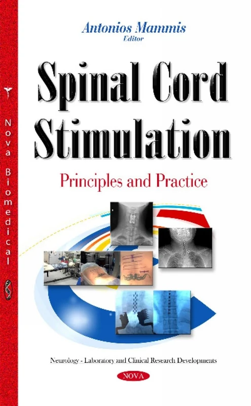 Spinal Cord Stimulation: Principles & Practice - Image 1