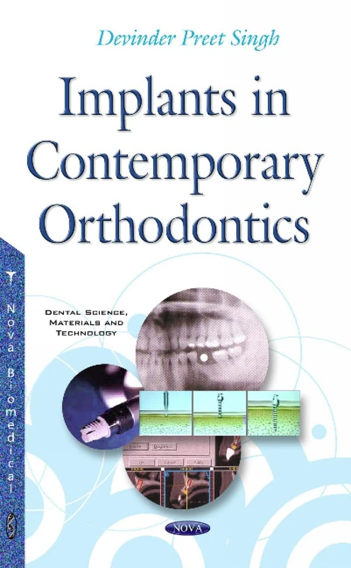 Implants in Contemporary Orthodontics (Dental Science, Materials and Technology)