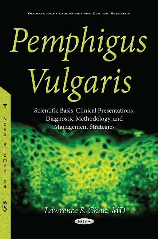 Pemphigus Vulgaris: Scientific Basis, Clinical Presentations, Diagnostic Methodology & Management Strategies