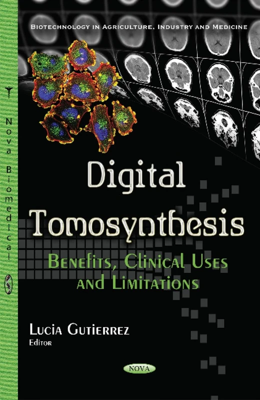 Digital Tomosynthesis: Benefits, Clinical Uses & Limitations - Image 1