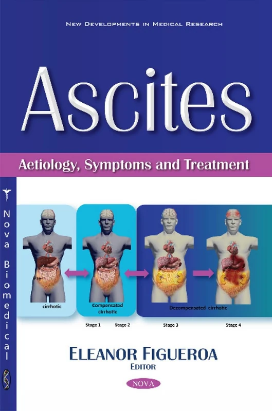 Ascites: Aetiology, Symptoms & Treatment (New Developments in Medical Research)