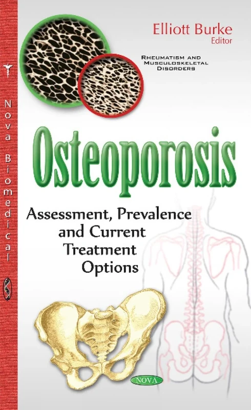 Osteoporosis: Assessment, Prevalence & Current Treatment Options (Rheumatism and Musculoskeletal Disorders)