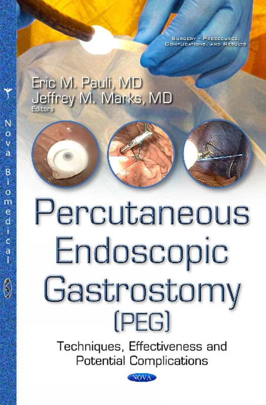 Percutaneous Endoscopic Gastrostomy (PEG) Medical Book