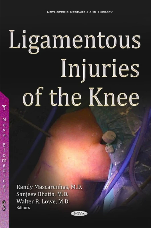 Ligamentous Injuries of the Knee (Orthopedic Research and Therapy)