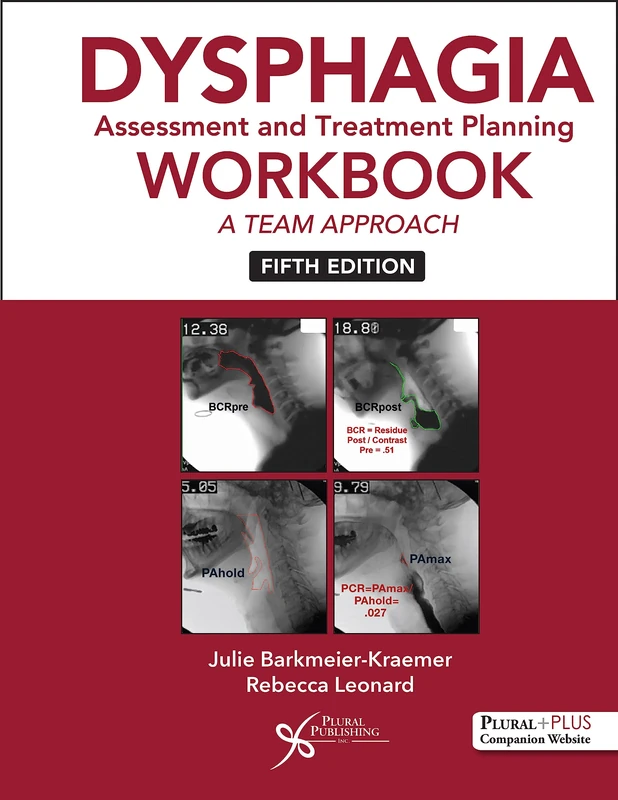 Dysphagia Assessment and Treatment Planning: A Team Approach
