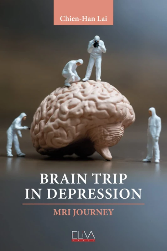 Brain Trip in Depression: MRI Journey - Image 1