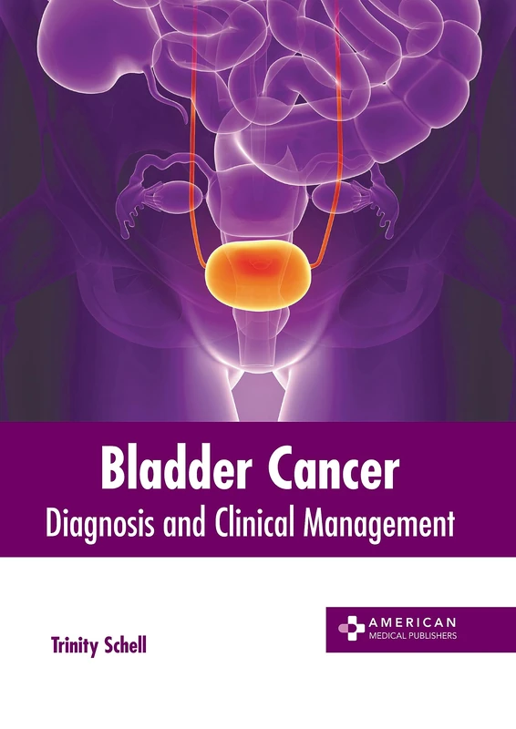 Bladder Cancer: Diagnosis and Clinical Management