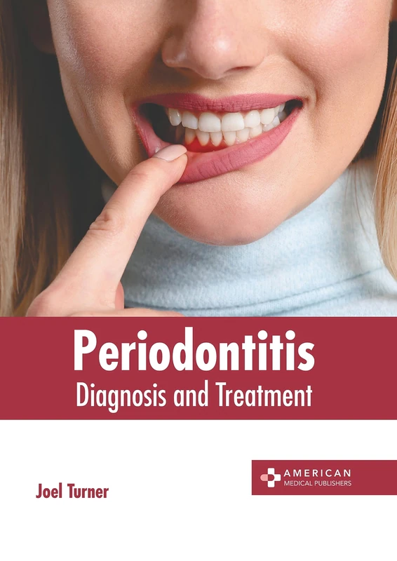 Periodontitis: Diagnosis and Treatment - American Medical Publishers