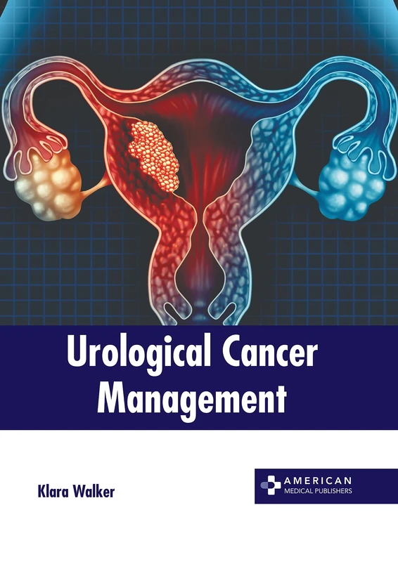 Urological Cancer Management - American Medical Publishers
