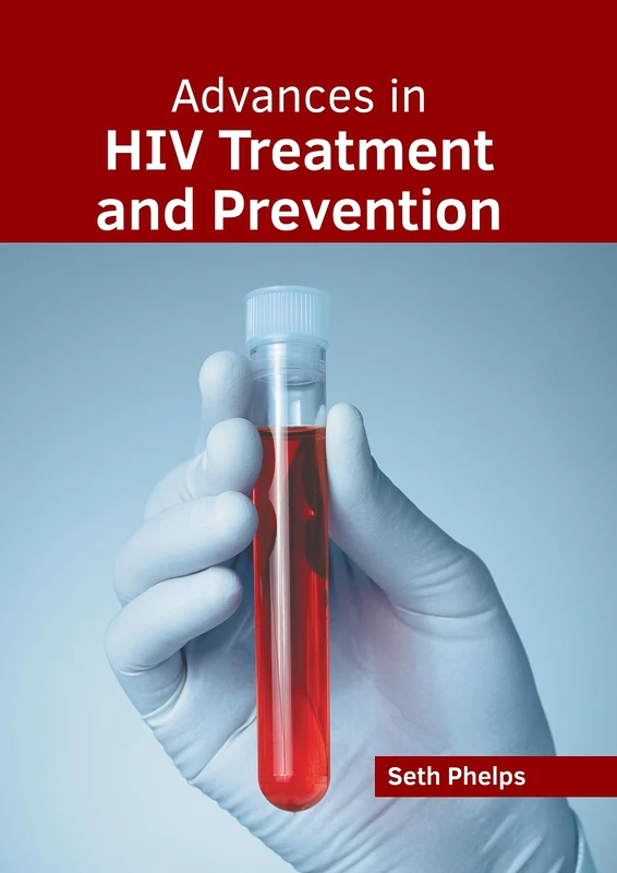 Advances in HIV Treatment and Prevention - Medical Book