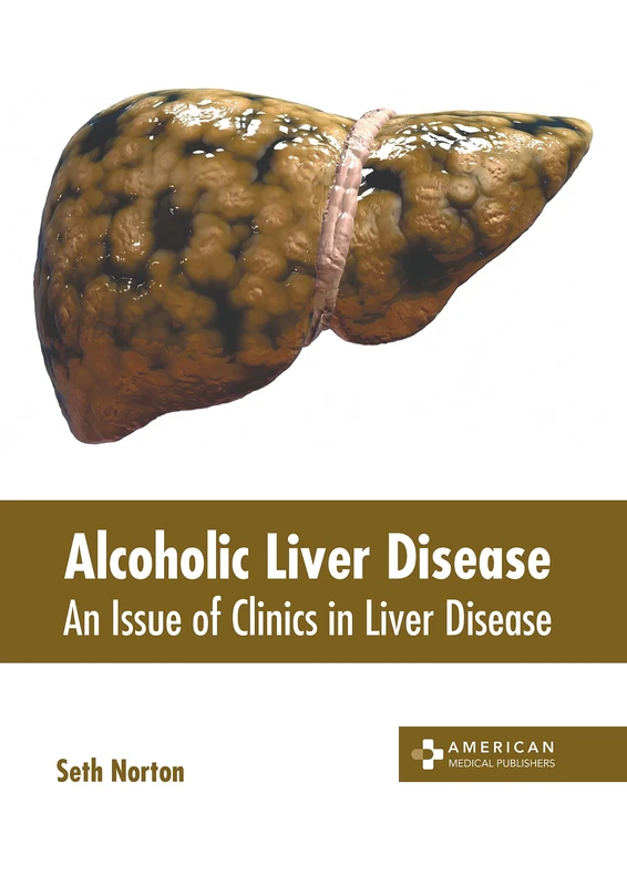 Alcoholic Liver Disease - Clinics in Liver Disease Book