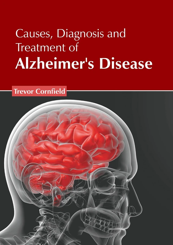 Causes, Diagnosis and Treatment of Alzheimer's Disease - Book