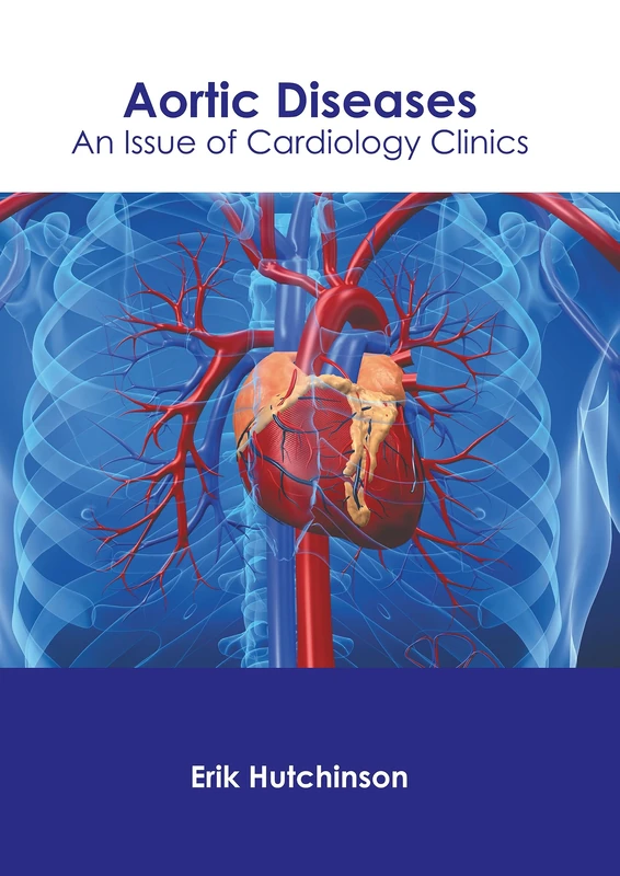 Aortic Diseases: An Issue of Cardiology Clinics - Image 1