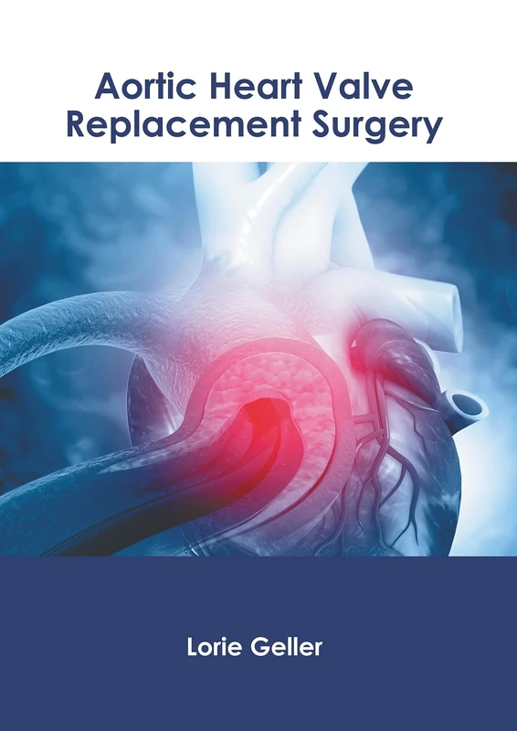 Aortic Heart Valve Replacement Surgery - Medical Textbook