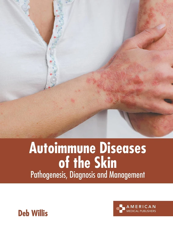 Autoimmune Diseases of the Skin - Medical Reference Book