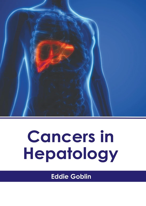 Cancers in Hepatology - American Medical Publishers Book