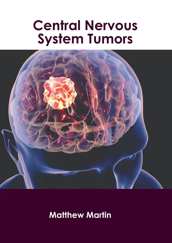 Central Nervous System Tumors - American Medical Publishers