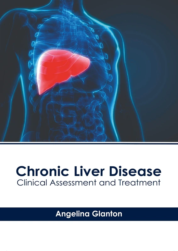 Chronic Liver Disease: Clinical Assessment and Treatment