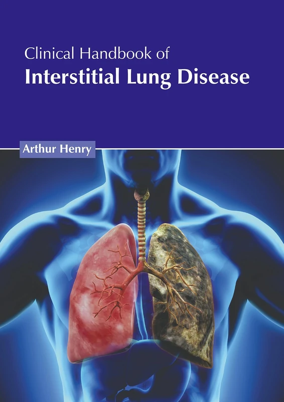 Clinical Handbook of Interstitial Lung Disease - Medical Guide