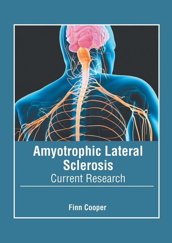 Amyotrophic Lateral Sclerosis: Current Research - Book