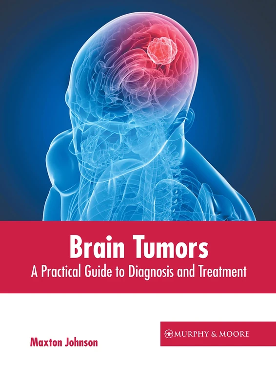 Brain Tumors: A Practical Guide to Diagnosis and Treatment