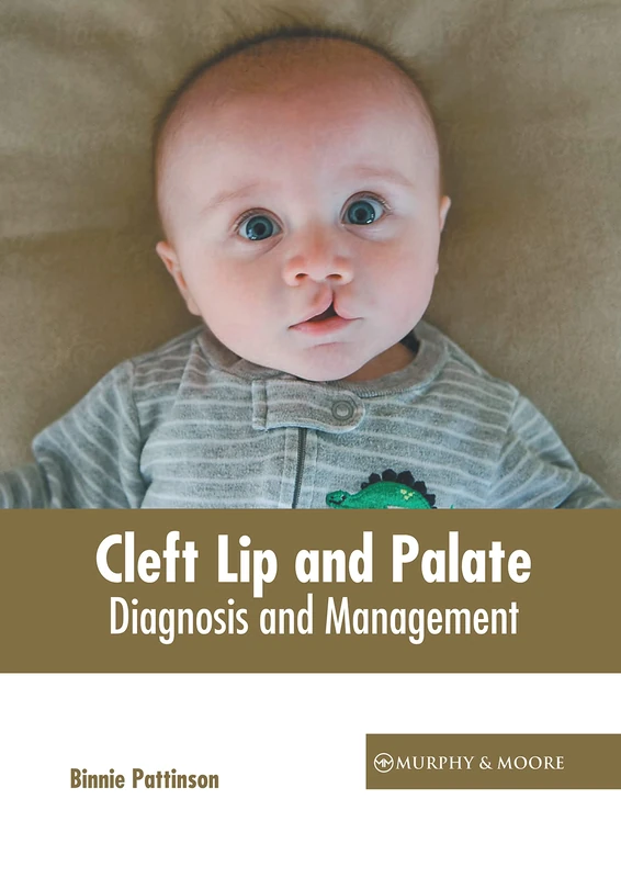 Cleft Lip and Palate: Diagnosis and Management - Image 1