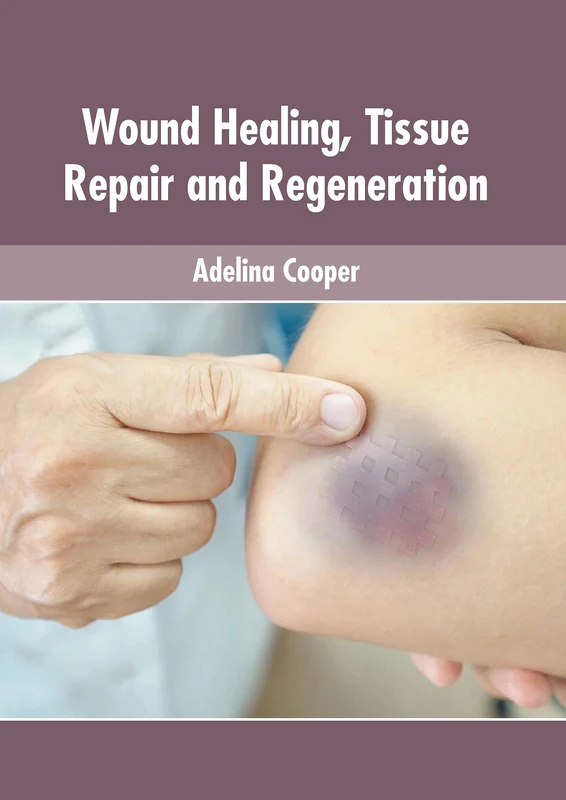 Wound Healing, Tissue Repair and Regeneration - Medical Book