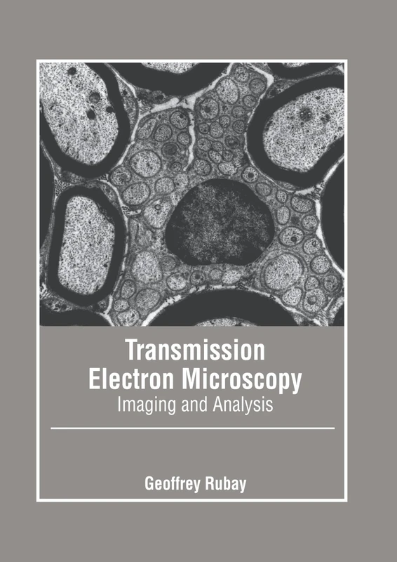 Transmission Electron Microscopy: Imaging and Analysis