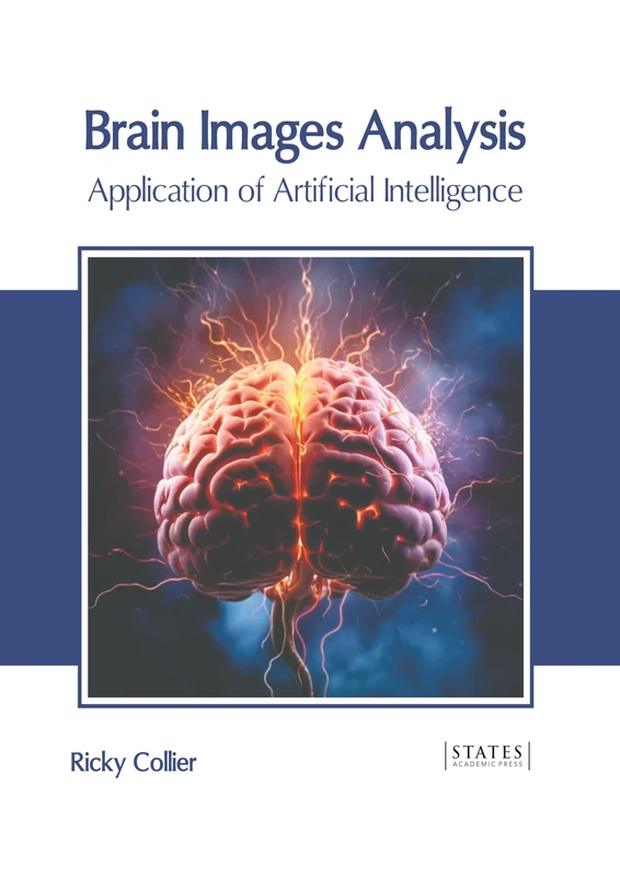 Brain Images Analysis: Application of Artificial Intelligence - Image 1