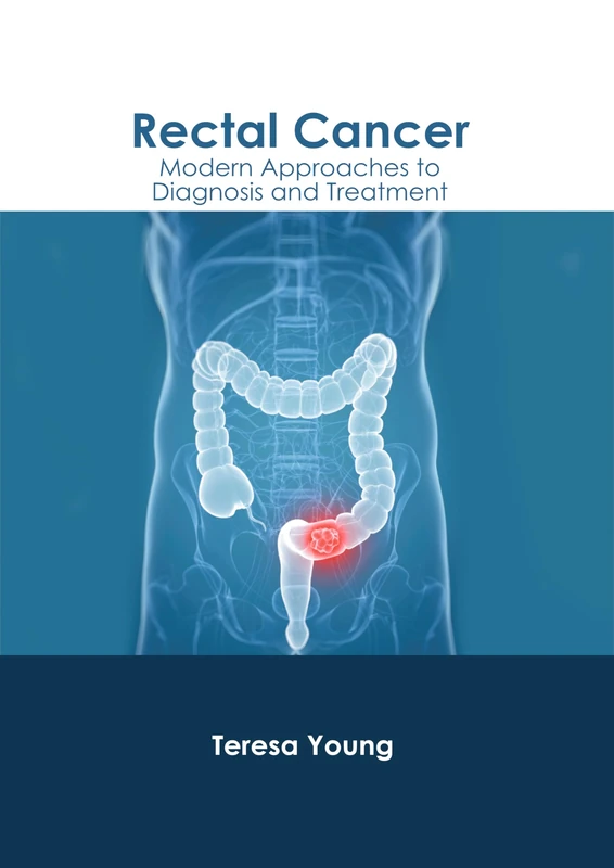Rectal Cancer: Modern Approaches to Diagnosis and Treatment