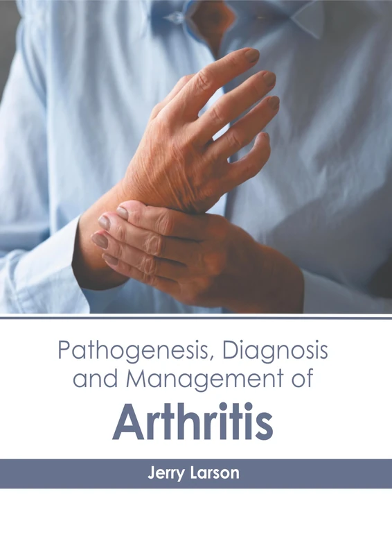 Pathogenesis, Diagnosis and Management of Arthritis