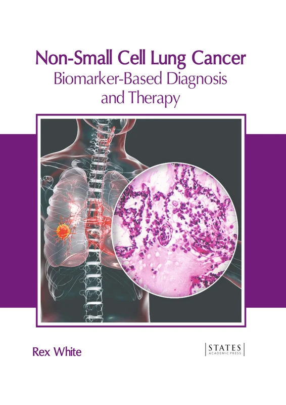Non-Small Cell Lung Cancer: Biomarker-Based Diagnosis and Therapy