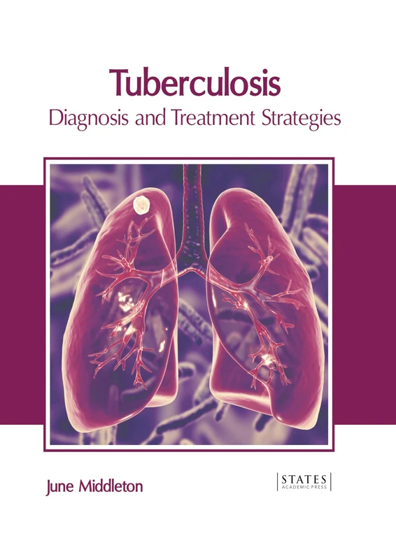 Tuberculosis: Diagnosis and Treatment Strategies