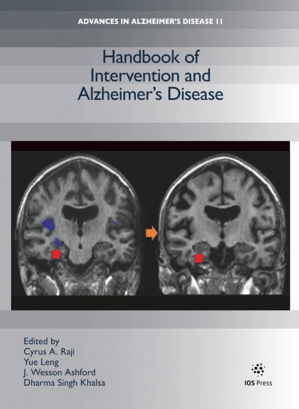 Handbook of Intervention and Alzheimer’s Disease (Advances in Alzheimer′s Disease (IOS Press))